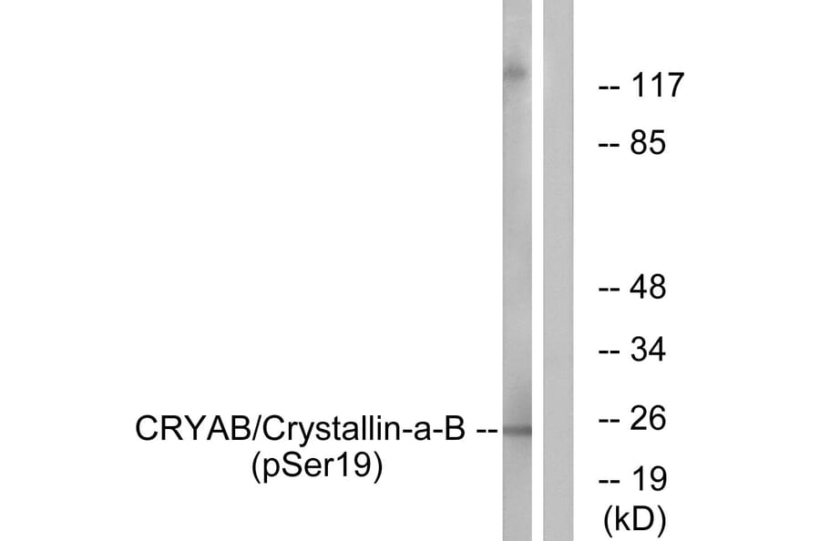 Western Blot - Anti-CRYAB (phospho Ser19) Antibody (A0895) - Antibodies.com