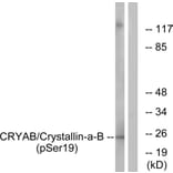Western Blot - Anti-CRYAB (phospho Ser19) Antibody (A0895) - Antibodies.com