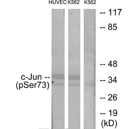Western Blot - Anti-c-Jun (phospho Ser73) Antibody (A7046) - Antibodies.com