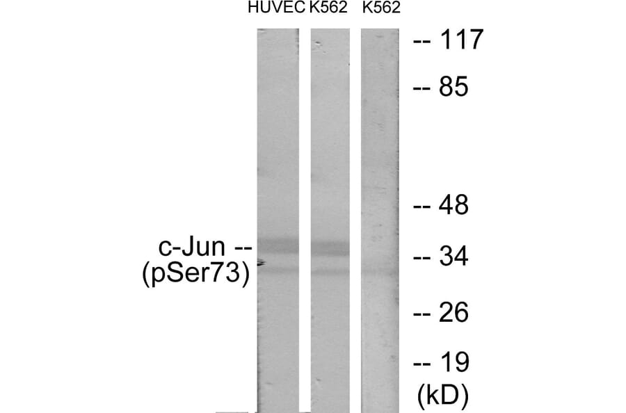Western Blot - Anti-c-Jun (phospho Ser73) Antibody (A7046) - Antibodies.com