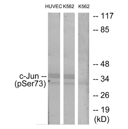 Western Blot - Anti-c-Jun (phospho Ser73) Antibody (A7046) - Antibodies.com