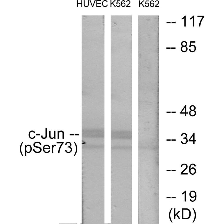 Western Blot - Anti-c-Jun (phospho Ser73) Antibody (A7046) - Antibodies.com
