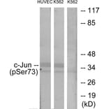 Western Blot - Anti-c-Jun (phospho Ser73) Antibody (A7046) - Antibodies.com