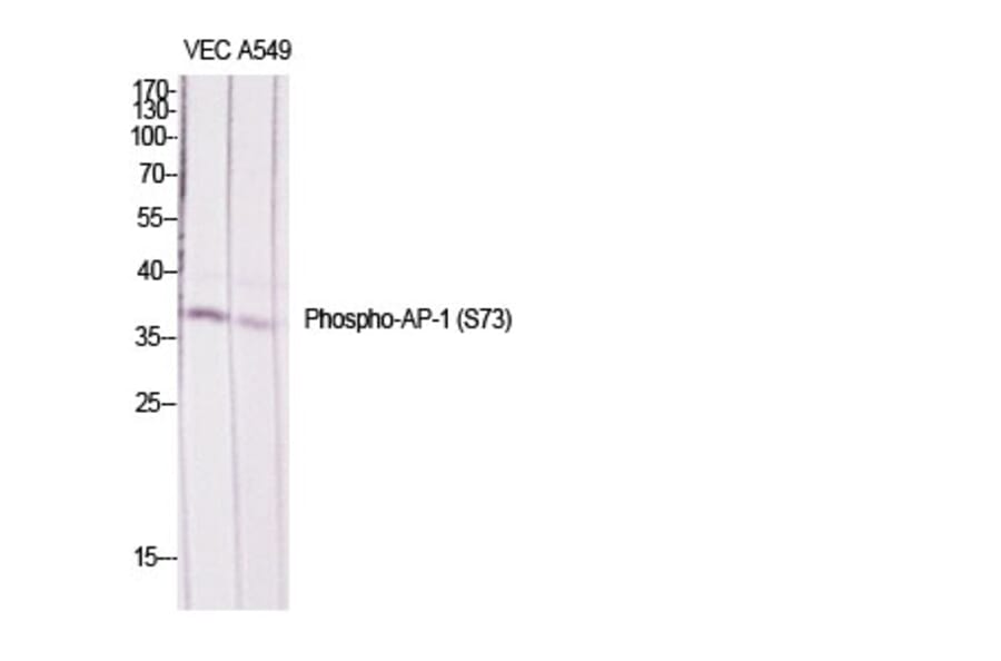 Western Blot - Anti-c-Jun (phospho Ser73) Antibody (A7046) - Antibodies.com