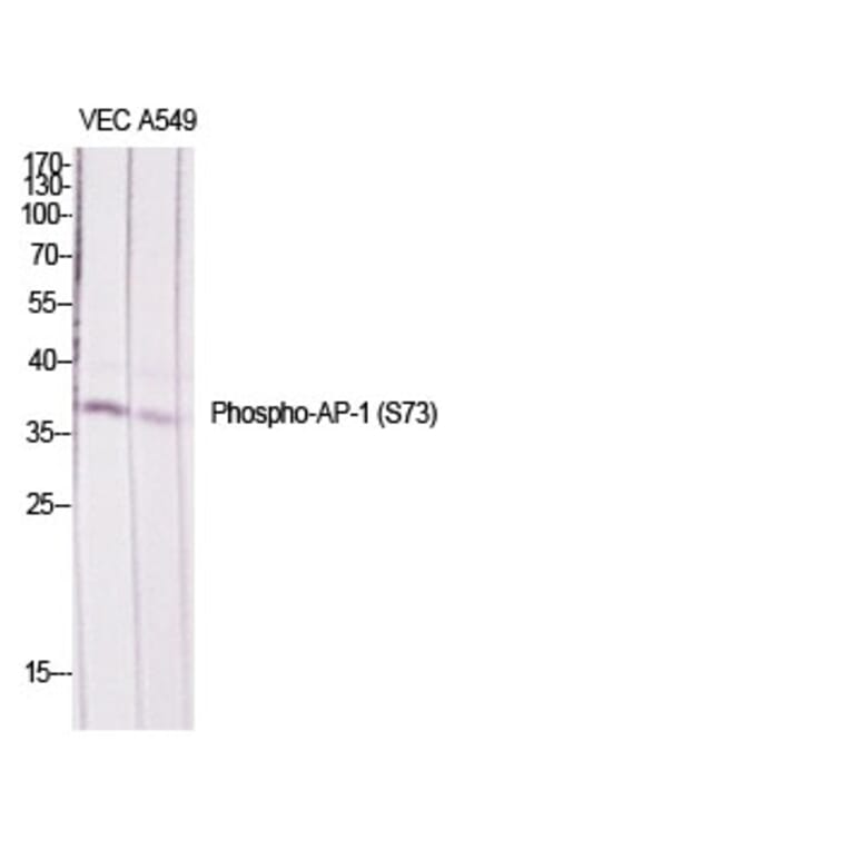 Western Blot - Anti-c-Jun (phospho Ser73) Antibody (A7046) - Antibodies.com