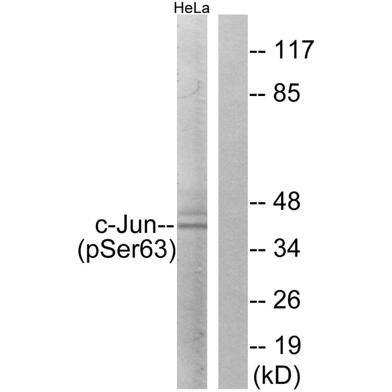 Western Blot - Anti-c-Jun (phospho Ser63) Antibody (A7045) - Antibodies.com