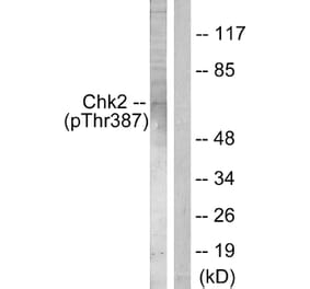 Western Blot - Anti-Chk2 (phospho Thr387) Antibody (A0414) - Antibodies.com