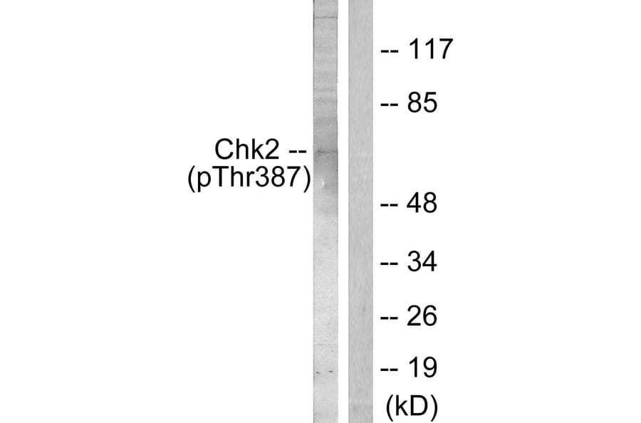 Western Blot - Anti-Chk2 (phospho Thr387) Antibody (A0414) - Antibodies.com