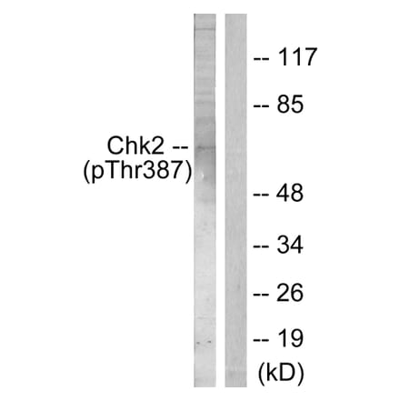 Western Blot - Anti-Chk2 (phospho Thr387) Antibody (A0414) - Antibodies.com