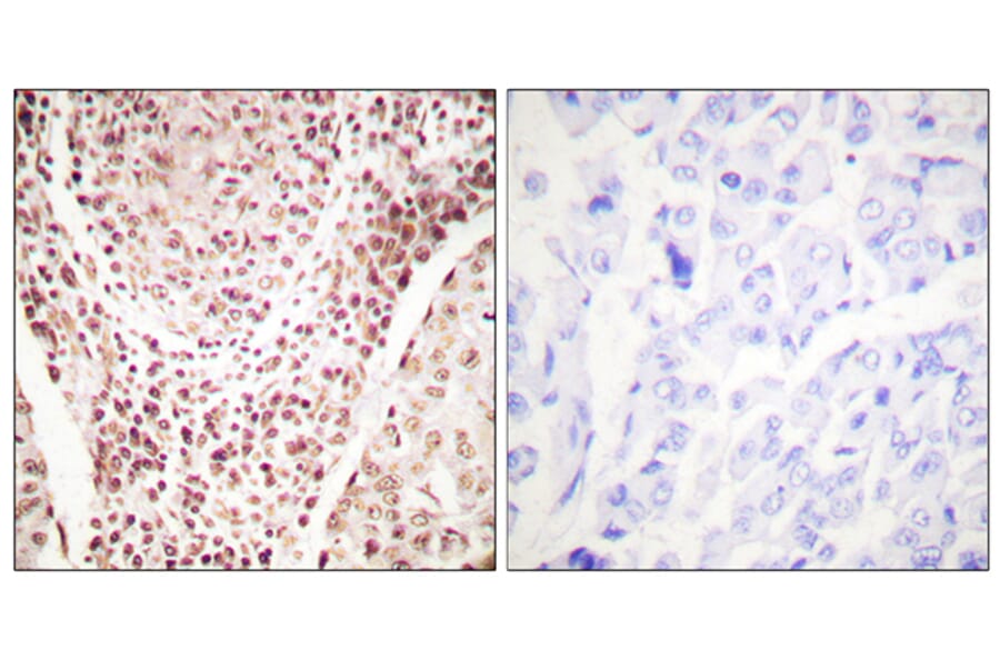 Immunohistochemistry - Anti-Chk2 (phospho Thr387) Antibody (A0414) - Antibodies.com