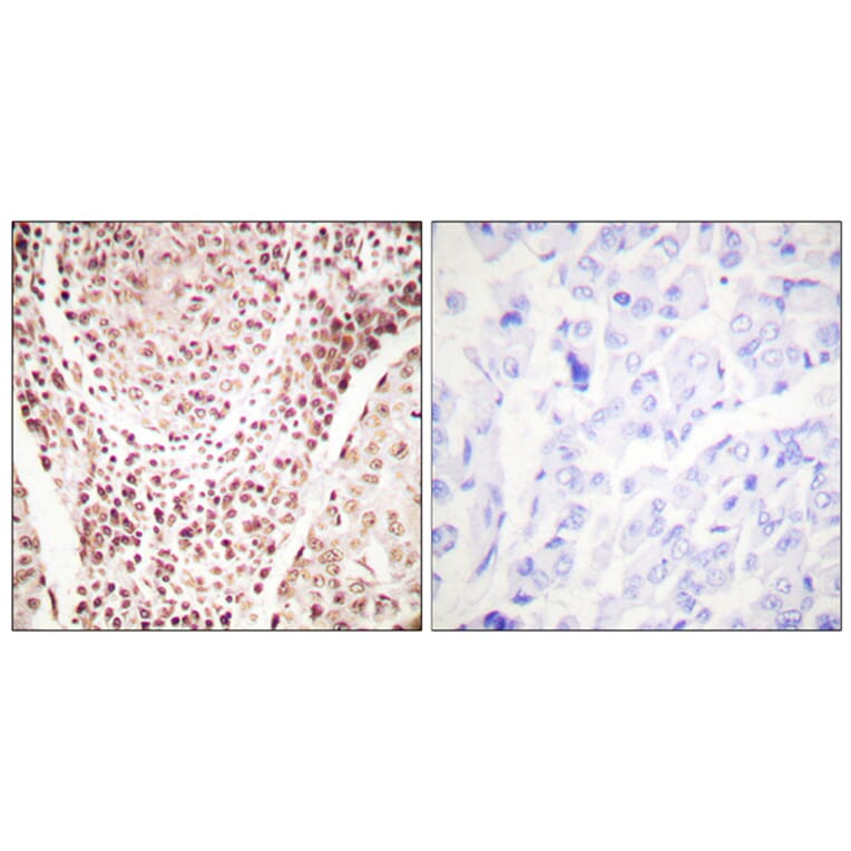 Immunohistochemistry - Anti-Chk2 (phospho Thr387) Antibody (A0414) - Antibodies.com