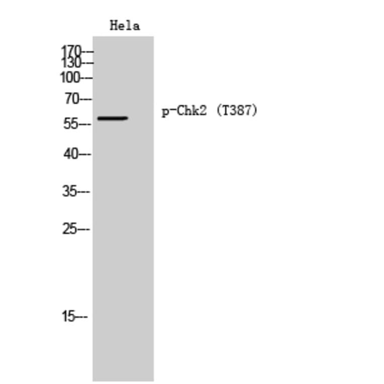 Western Blot - Anti-Chk2 (phospho Thr387) Antibody (A0414) - Antibodies.com