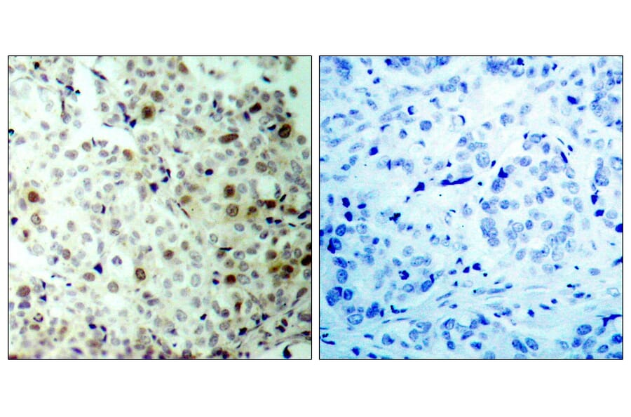 Immunohistochemistry - Anti-CDK2 (phospho Thr160) Antibody (A7039) - Antibodies.com