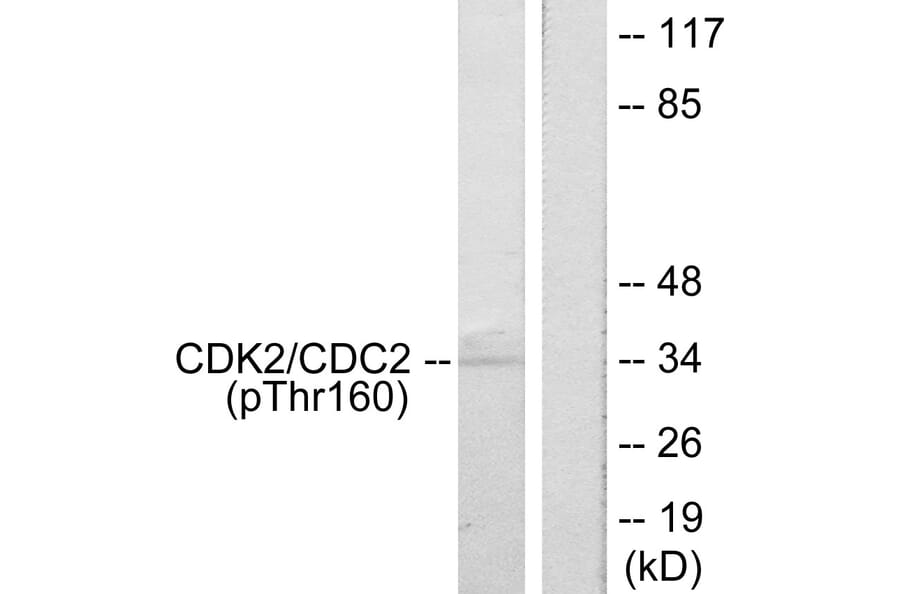 Western Blot - Anti-CDK2 (phospho Thr160) Antibody (A7039) - Antibodies.com
