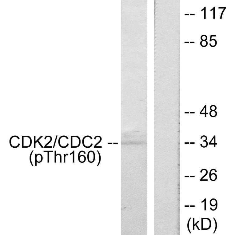 Western Blot - Anti-CDK2 (phospho Thr160) Antibody (A7039) - Antibodies.com