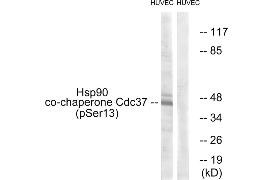 Western Blot - Anti-CDC37 (phospho Ser13) Antibody (A1048) - Antibodies.com