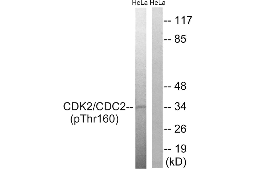 Western Blot - Anti-CDC2 (phospho Thr161) Antibody (A7035) - Antibodies.com
