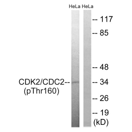 Western Blot - Anti-CDC2 (phospho Thr161) Antibody (A7035) - Antibodies.com