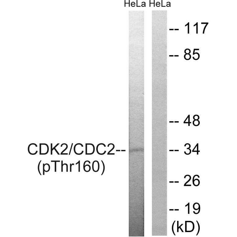 Western Blot - Anti-CDC2 (phospho Thr161) Antibody (A7035) - Antibodies.com