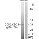 Western Blot - Anti-CDC2 (phospho Thr161) Antibody (A7035) - Antibodies.com