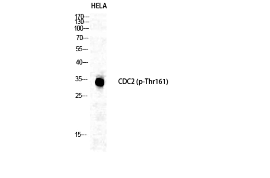 Western Blot - Anti-CDC2 (phospho Thr161) Antibody (A7035) - Antibodies.com