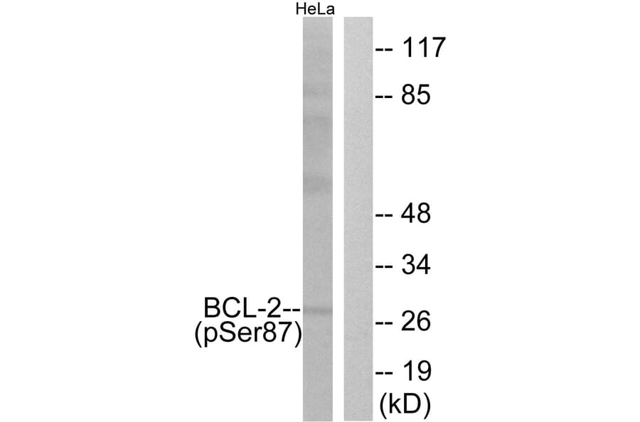 Western Blot - Anti-BCL-2 (phospho Ser87) Antibody (A0460) - Antibodies.com