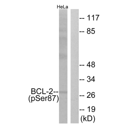Western Blot - Anti-BCL-2 (phospho Ser87) Antibody (A0460) - Antibodies.com