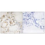 Immunohistochemistry - Anti-BCL-2 (phospho Ser87) Antibody (A0460) - Antibodies.com