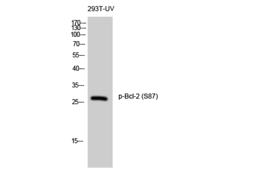 Western Blot - Anti-BCL-2 (phospho Ser87) Antibody (A0460) - Antibodies.com