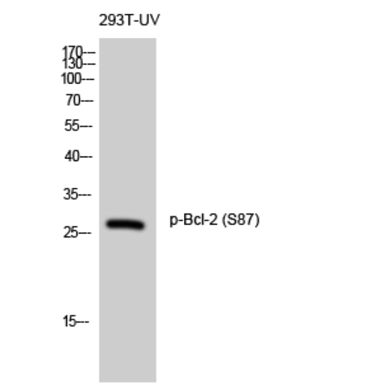 Western Blot - Anti-BCL-2 (phospho Ser87) Antibody (A0460) - Antibodies.com