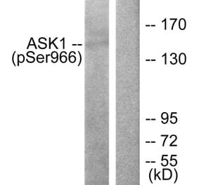 Western Blot - Anti-ASK1 (phospho Ser966) Antibody (A7011) - Antibodies.com