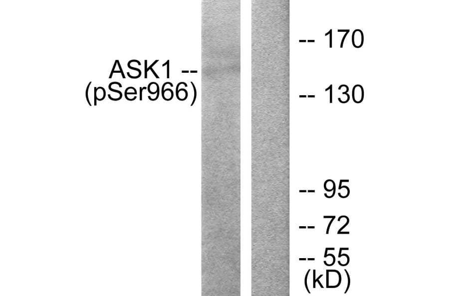 Western Blot - Anti-ASK1 (phospho Ser966) Antibody (A7011) - Antibodies.com