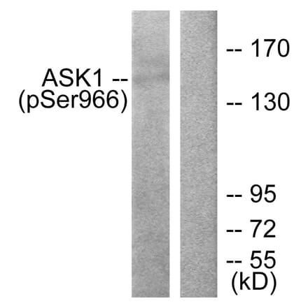 Western Blot - Anti-ASK1 (phospho Ser966) Antibody (A7011) - Antibodies.com