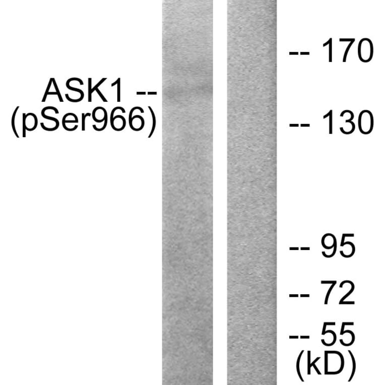 Western Blot - Anti-ASK1 (phospho Ser966) Antibody (A7011) - Antibodies.com