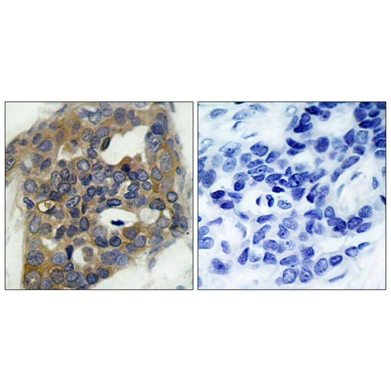 Immunohistochemistry - Anti-ASK1 (phospho Ser966) Antibody (A7011) - Antibodies.com