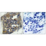 Immunohistochemistry - Anti-ASK1 (phospho Ser966) Antibody (A7011) - Antibodies.com