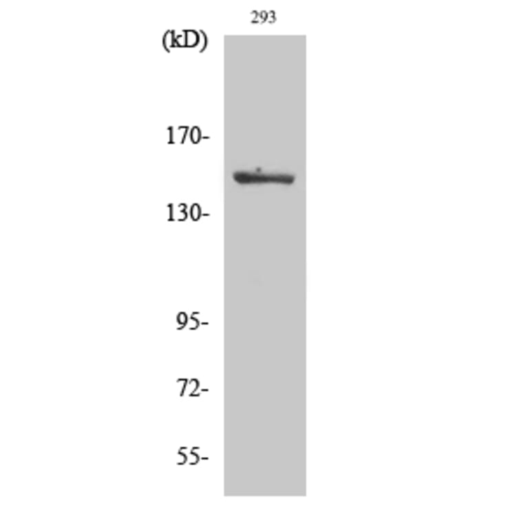 Western Blot - Anti-ASK1 (phospho Ser966) Antibody (A7011) - Antibodies.com