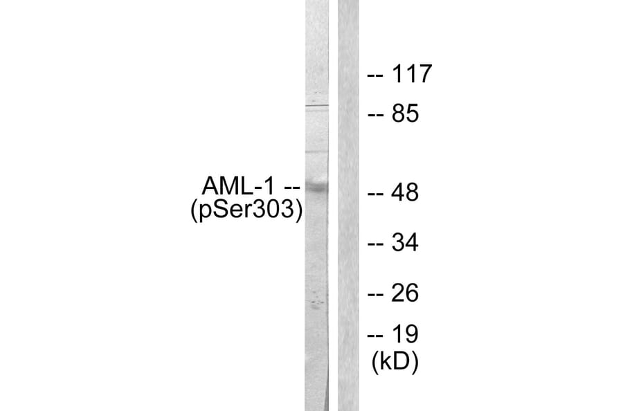 Western Blot - Anti-AML1 (phospho Ser303) Antibody (A0409) - Antibodies.com