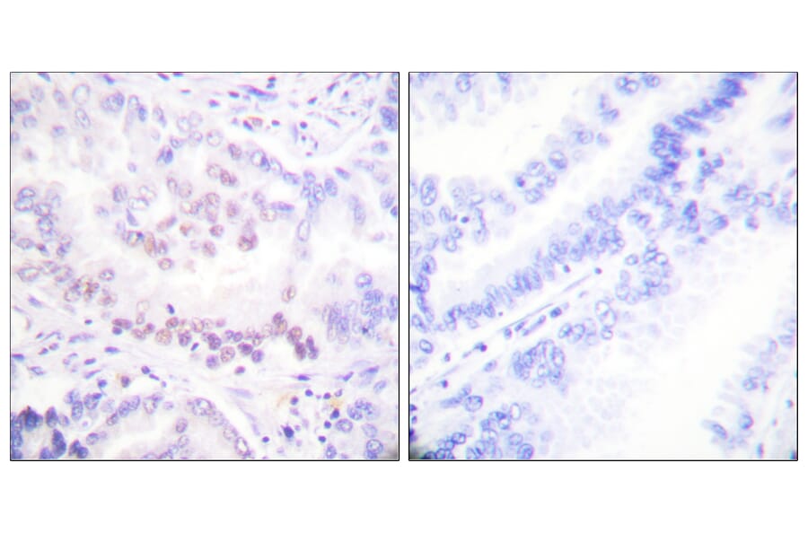 Immunohistochemistry - Anti-AML1 (phospho Ser303) Antibody (A0409) - Antibodies.com