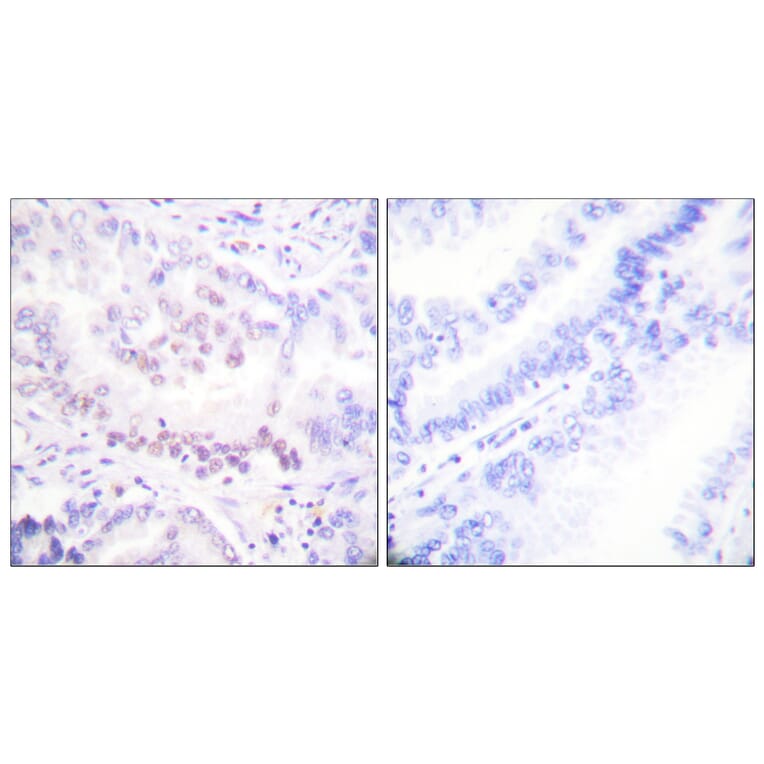 Immunohistochemistry - Anti-AML1 (phospho Ser303) Antibody (A0409) - Antibodies.com