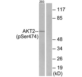 Western Blot - Anti-Akt2 (phospho Ser474) Antibody (A7006) - Antibodies.com
