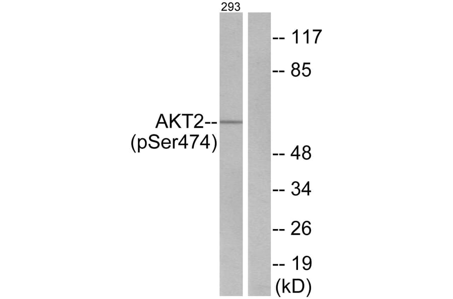 Western Blot - Anti-Akt2 (phospho Ser474) Antibody (A7006) - Antibodies.com
