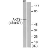 Western Blot - Anti-Akt2 (phospho Ser474) Antibody (A7006) - Antibodies.com