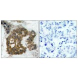 Immunohistochemistry - Anti-Akt2 (phospho Ser474) Antibody (A7006) - Antibodies.com