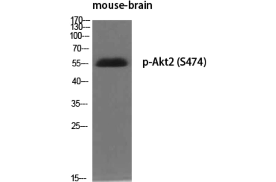 Western Blot - Anti-Akt2 (phospho Ser474) Antibody (A7006) - Antibodies.com