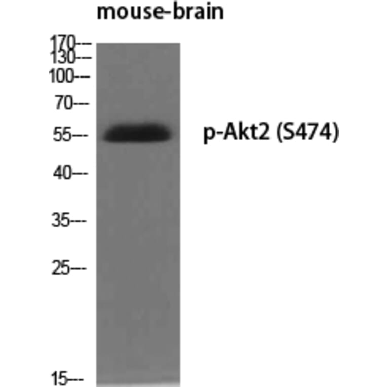 Western Blot - Anti-Akt2 (phospho Ser474) Antibody (A7006) - Antibodies.com