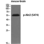 Western Blot - Anti-Akt2 (phospho Ser474) Antibody (A7006) - Antibodies.com