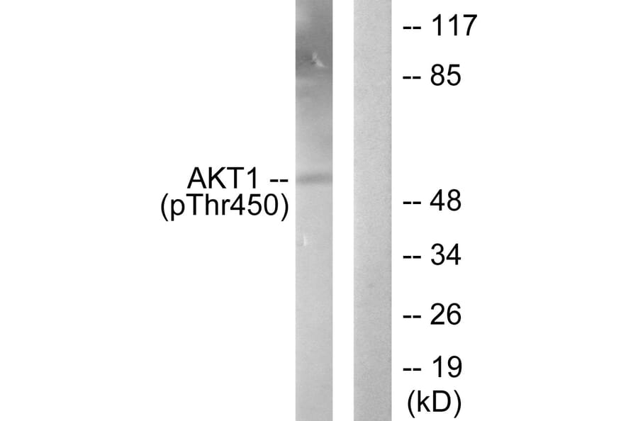 Western Blot - Anti-Akt1 (phospho Thr450) Antibody (A0406) - Antibodies.com