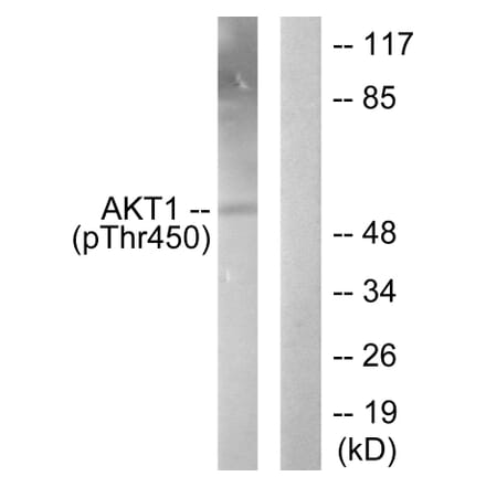 Western Blot - Anti-Akt1 (phospho Thr450) Antibody (A0406) - Antibodies.com