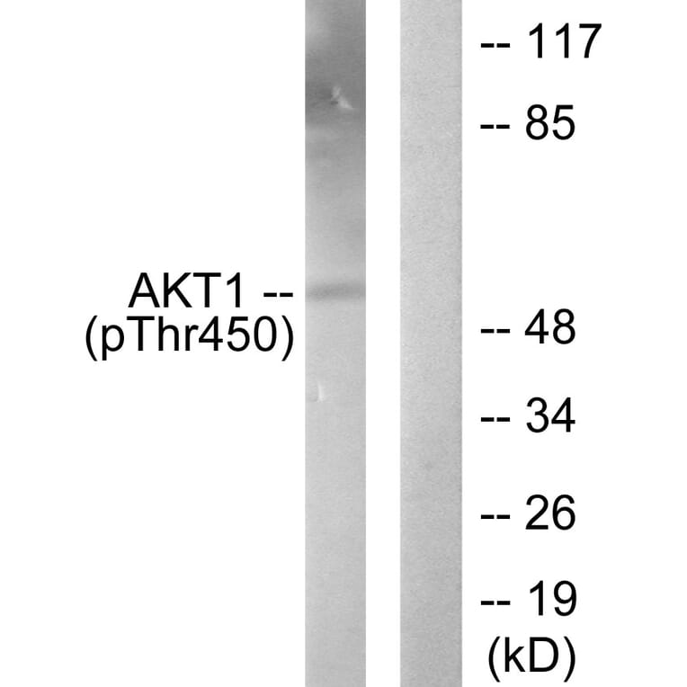 Western Blot - Anti-Akt1 (phospho Thr450) Antibody (A0406) - Antibodies.com